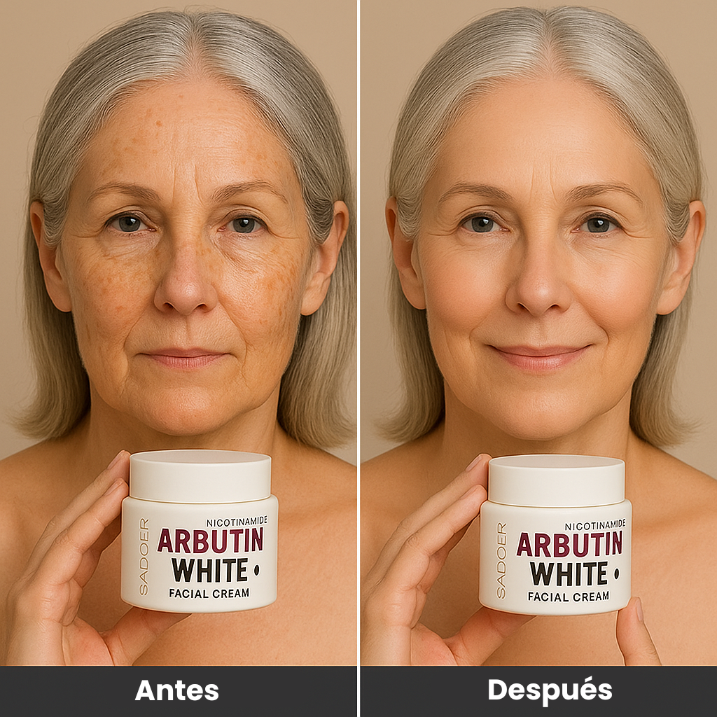 ✨ lleva 3 Arbutin White + 1 Elixir Antiedad de regalo! Dile adiós a las manchas y al acné revela tu verdadera piel 💖