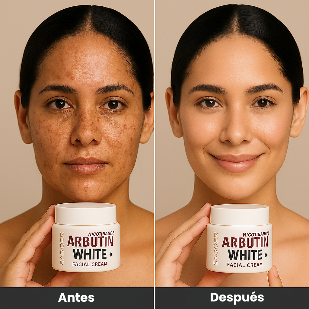 ✨ lleva 3 Arbutin White + 1 Elixir Antiedad de regalo! Dile adiós a las manchas y al acné revela tu verdadera piel 💖